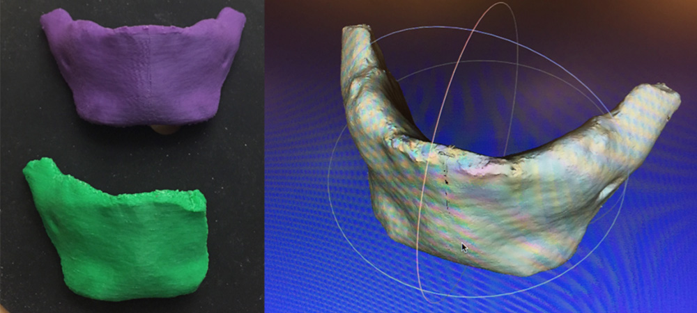 1的3 d印刷古人类下颌,形象的形象问题上下颌在3 d建模程序